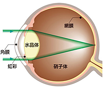白内障の症状・健康な人の水晶体